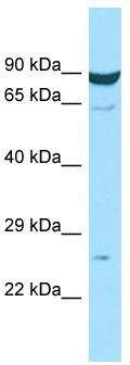 WB Suggested Anti-MS4A7 Antibody; Titration: 1.0 ug/ml; Positive Control: Hela Whole Cell