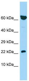 Host: Rabbit; Target Name: PBOV1; Sample Tissue: 721_B Whole Cell lysates; Antibody Dilution: 1.0ug/ml; PBOV1 is supported by BioGPS gene expression data to be expressed in 721_B