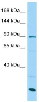 WB Suggested Anti-SCUBE3 Antibody; Titration: 1.0 ug/ml; Positive Control: MCF7 Whole Cell