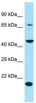 WB Suggested Anti-SLC13A4 Antibody; Titration: 1.0 ug/ml; Positive Control: Jurkat Whole Cell