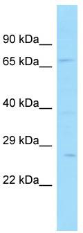Host: Rabbit; Target Name: SNX33; Sample Tissue: 721_B Whole Cell lysates; Antibody Dilution: 1.0ug/ml
