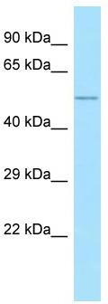 WB Suggested Anti-ALG10 Antibody; Titration: 1.0 ug/ml; Positive Control: Placenta