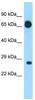 WB Suggested Anti-EIF4E1B Antibody; Titration: 1.0 ug/ml; Positive Control: Fetal Heart