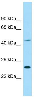 WB Suggested Anti-EIF4E1B Antibody; Titration: 1.0 ug/ml; Positive Control: NCI-H226 Whole Cell
