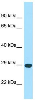 WB Suggested Anti-OFCC1 Antibody; Titration: 1.0 ug/ml; Positive Control: RPMI-8226 Whole Cell