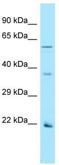 Host: Rabbit; Target Name: OR2AG1; Sample Tissue: Hela Whole Cell lysates; Antibody Dilution: 1.0 ug/ml
