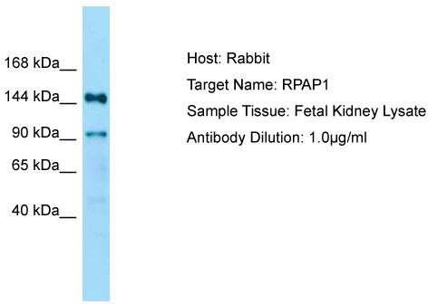Host: Rabbit; Target Name: RPAP1; Sample Tissue: Fetal Kidney lysates; Antibody Dilution: 1.0 ug/ml