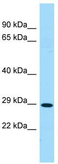 Host: Rabbit; Target Name: SLC35D1; Sample Tissue: Fetal Heart lysates; Antibody Dilution: 1.0 ug/ml
