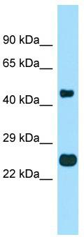 WB Suggested Anti-TMBIM4 Antibody; Titration: 1.0 ug/ml; Positive Control: Placenta