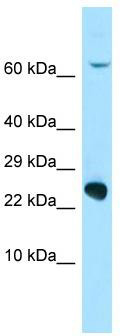 WB Suggested Anti-VKORC1L1 Antibody; Titration: 1.0 ug/ml; Positive Control: HepG2 Whole Cell