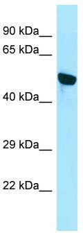 WB Suggested Anti-WDR18 Antibody; Titration: 1.0 ug/ml; Positive Control: Jurkat Whole CellWDR18 is supported by BioGPS gene expression data to be expressed in Jurkat