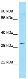 WB Suggested Anti-C9orf24 Antibody; Titration: 1.0 ug/ml; Positive Control: Hela Whole cell