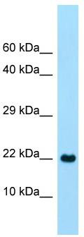 WB Suggested Anti-CLEC2A Antibody; Titration: 1.0 ug/ml; Positive Control: Fetal Heart