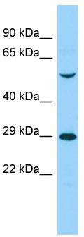 Host: Rabbit; Target Name: ENDOD1; Sample Tissue: 293T Whole Cell lysates; Antibody Dilution: 1.0 ug/ml