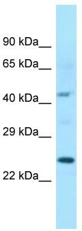 WB Suggested Anti-ISOC1 Antibody; Titration: 1.0 ug/ml; Positive Control: Fetal Heart