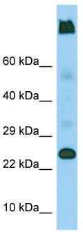 Host: Rabbit; Target Name: LY6G5C; Sample Tissue: U937 Whole Cell lysates; Antibody Dilution: 1.0 ug/ml