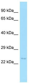 Host: Rabbit; Target Name: MOSPD1; Sample Tissue: HCT15 Whole Cell lysates; Antibody Dilution: 1.0 ug/ml