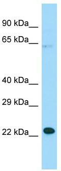 WB Suggested Anti-MOSPD1 Antibody; Titration: 1.0 ug/ml; Positive Control: Hela Whole Cell