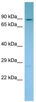 Host: Rabbit; Target Name: NADSYN1; Sample Tissue: PANC1 Whole Cell lysates; Antibody Dilution: 1.0 ug/ml