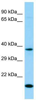 Host: Rabbit; Target Name: OR7D4; Sample Tissue: 293T Whole Cell lysates; Antibody Dilution: 1.0 ug/ml