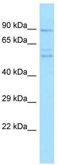 Host: Rabbit; Target Name: PPEF2; Sample Tissue: PANC1 Whole Cell lysates; Antibody Dilution: 1.0 ug/ml