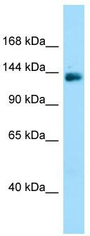 WB Suggested Anti-PPP1R9A Antibody; Titration: 1.0 ug/ml; Positive Control: Fetal Brain