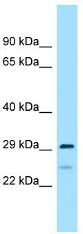 WB Suggested Anti-RPS4Y2 Antibody; Titration: 1.0 ug/ml; Positive Control: 721_B Whole Cell