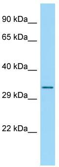 Host: Rabbit; Target Name: RPS4Y2; Sample Tissue: 293T Whole Cell lysates; Antibody Dilution: 1.0 ug/ml