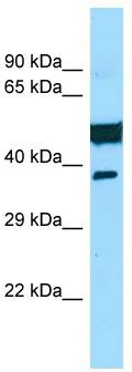 WB Suggested Anti-SAMD3 Antibody; Titration: 1.0 ug/ml; Positive Control: Hela Whole Cell