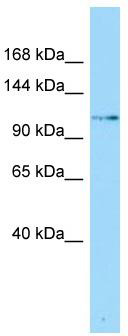 Host: Rabbit; Target Name: SLFN5; Sample Tissue: Fetal Heart lysates; Antibody Dilution: 1.0 ug/ml