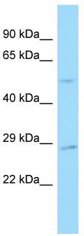 Host: Rabbit; Target Name: SNX30; Sample Tissue: 721_B Whole Cell lysates; Antibody Dilution: 1.0 ug/ml