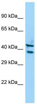 Host: Rabbit; Target Name: STK35; Sample Tissue: A549 Whole Cell lysates; Antibody Dilution: 1.0 ug/ml