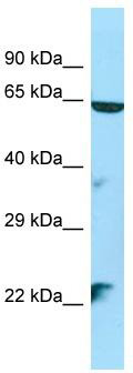 WB Suggested Anti-STK35 Antibody; Titration: 1.0 ug/ml; Positive Control: HepG2 Whole Cell