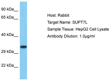 Host: Rabbit; Target Name: SUPT7L; Sample Tissue: HepG2 Whole Cell lysates; Antibody Dilution: 1.0 ug/ml