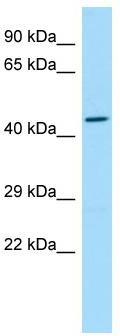 WB Suggested Anti-SLC35G2 Antibody; Titration: 1.0 ug/ml; Positive Control: Fetal Heart