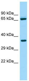 Host: Rabbit; Target Name: ALDH16A1; Sample Tissue: ACHN Whole Cell lysates; Antibody Dilution: 1.0 ug/ml