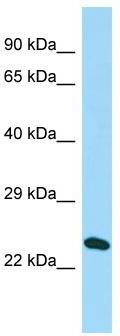 Host: Rabbit; Target Name: C16orf53; Sample Tissue: Hela Whole cell lysates; Antibody Dilution: 1.0ug/ml; PAGR1 is supported by BioGPS gene expression data to be expressed in HeLa