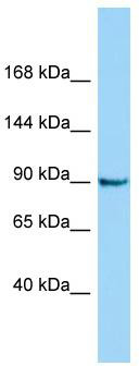 Host: Rabbit; Target Name: CRNKL1; Sample Tissue: Jurkat Whole Cell lysates; Antibody Dilution: 1.0ug/ml