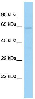 Host: Rabbit; Target Name: DEPDC1B; Sample Tissue: 293T Whole Cell lysates; Antibody Dilution: 1.0ug/ml
