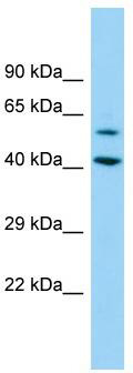 Host: Rabbit; Target Name: DEPDC1B; Sample Tissue: 293T Whole Cell lysates; Antibody Dilution: 1.0ug/ml