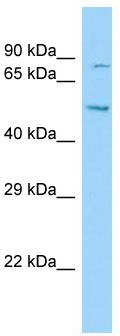 Host: Rabbit; Target Name: DNAH12; Sample Tissue: Hela Whole cell lysates; Antibody Dilution: 1.0ug/ml