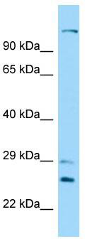 Host: Rabbit; Target Name: DNAH12; Sample Tissue: 721_B Whole Cell lysates; Antibody Dilution: 1.0ug/ml