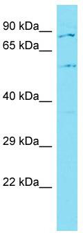 Host: Rabbit; Target Name: GLT25D2; Sample Tissue: MCF7 Whole Cell lysates; Antibody Dilution: 1.0ug/ml