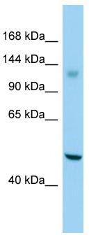 Host: Rabbit; Target Name: GPR158; Sample Tissue: Jurkat Whole Cell lysates; Antibody Dilution: 1.0ug/ml
