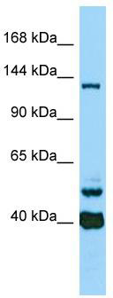 Host: Rabbit; Target Name: CAMSAP3; Sample Tissue: ACHN Whole Cell lysates; Antibody Dilution: 1.0ug/ml