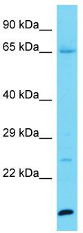 Host: Rabbit; Target Name: KPRP; Sample Tissue: Jurkat Whole Cell lysates; Antibody Dilution: 1.0ug/ml