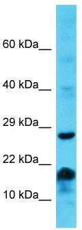 Host: Rabbit; Target Name: MS4A6E; Sample Tissue: Jurkat Whole Cell lysates; Antibody Dilution: 1.0ug/ml