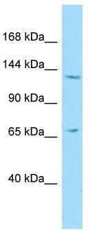 Host: Rabbit; Target Name: NEMF; Sample Tissue: HepG2 Whole Cell lysates; Antibody Dilution: 1.0ug/ml
