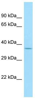 Host: Rabbit; Target Name: OR1A2; Sample Tissue: MCF7 Whole Cell lysates; Antibody Dilution: 1.0ug/ml