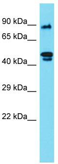 Host: Rabbit; Target Name: RSPH4A; Sample Tissue: 721_B Whole Cell lysates; Antibody Dilution: 1.0ug/ml